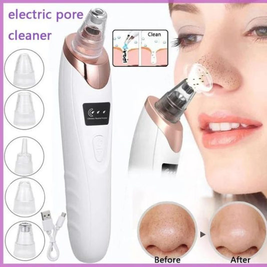 Blackhead Remover | Face Acne Black Dot Pimple Electric Blackhead Vacuum Cleaner