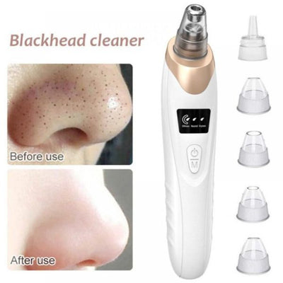 Blackhead Remover | Face Acne Black Dot Pimple Electric Blackhead Vacuum Cleaner